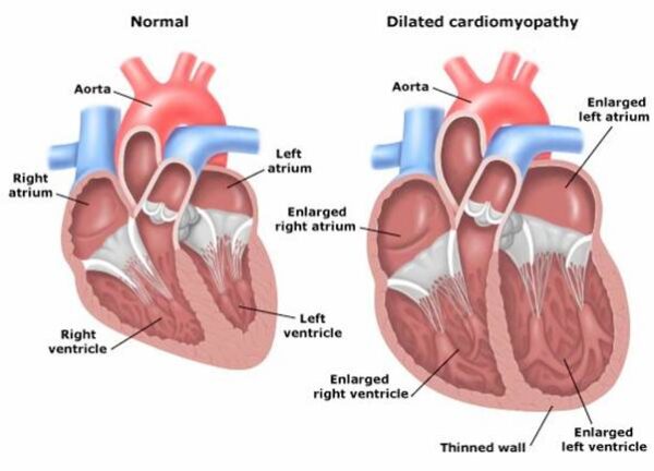 Hereditary Canine Cardiac Diseases – Dilated Cardiomyopathy (DCM ...