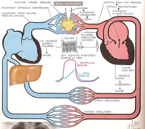 Acquired Canine Cardiac Diseases – Mitral Valve Disease (MVD) | Bichon ...